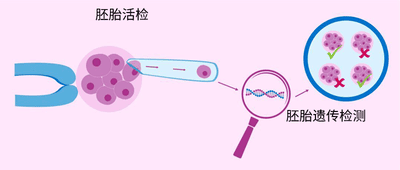 出现胎心胎芽还会胎停?这几个高危因素不可忽视！