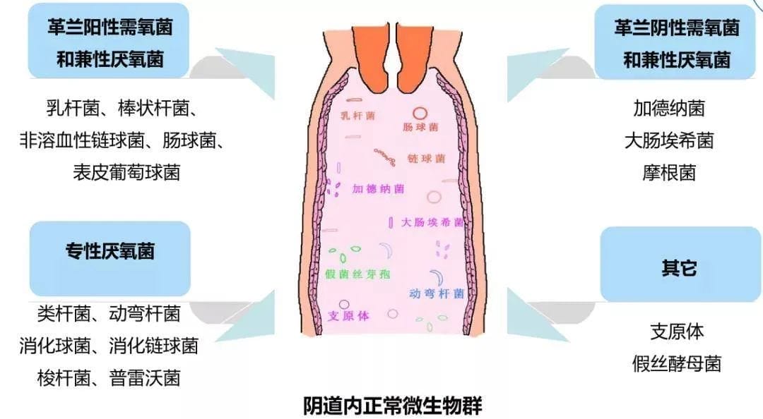 女性生殖道感染对辅助生殖技术妊娠结局的影响！