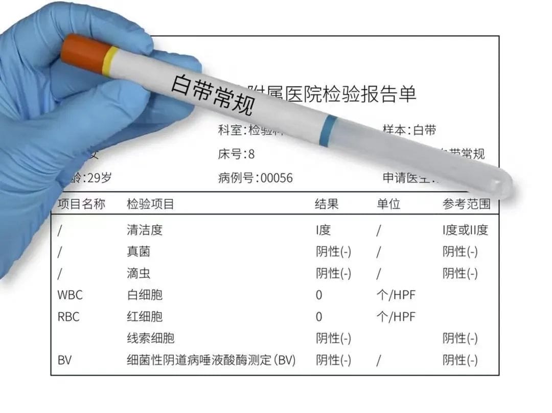 女性生殖道感染对辅助生殖技术妊娠结局的影响！