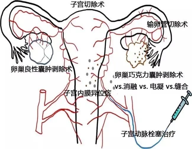 大家都是小仙女，AMH数值凭什么不一样?