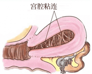 想要提高移植成功率，这项检查必不可少！