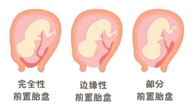 5、30、35？到底啥时候才是生孩子的黄金年龄？"