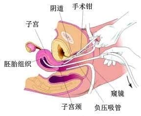 个保养卵巢的办法，但70%的女性做不到！"