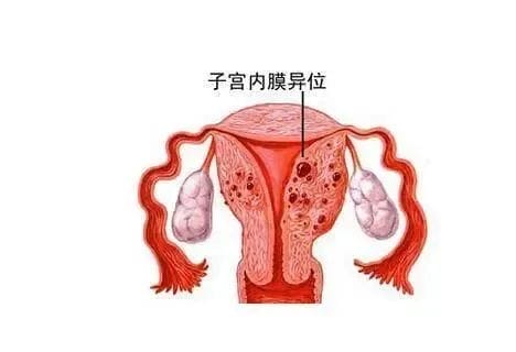 个保养卵巢的办法，但70%的女性做不到！"