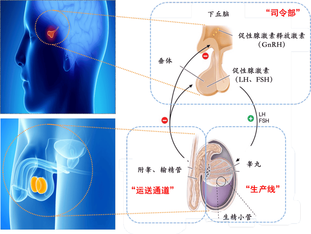 全文总结！关于男性不育那些事儿你必须要知道