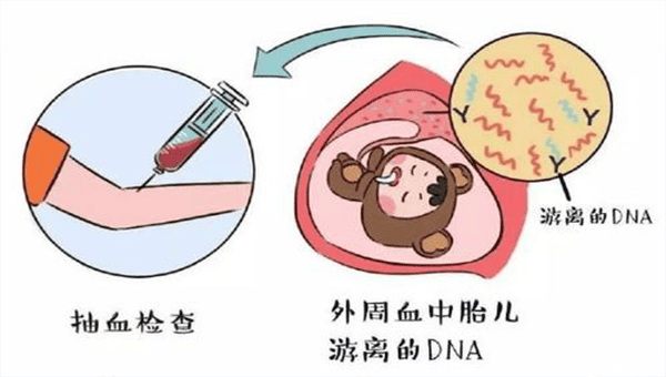 孕期做无创DNA可别胡乱做，搞不清这些问题等于白做！