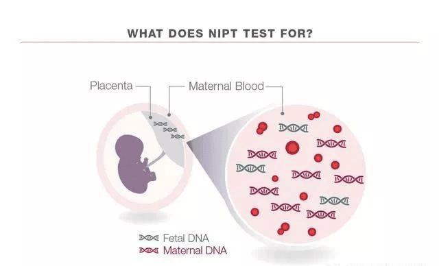 孕期做无创DNA可别胡乱做，搞不清这些问题等于白做！