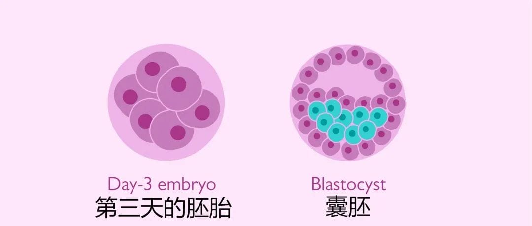 单囊胚移植已成为辅助生殖技术的国际主流！