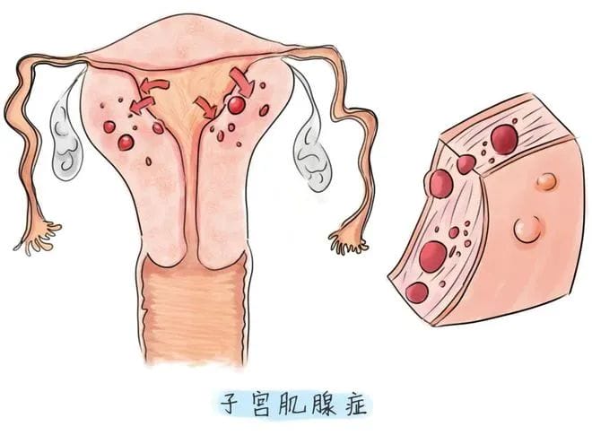 试管婴儿反复着床失败？这些原因你排查了吗?