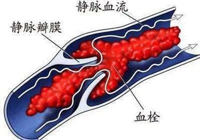 试管婴儿反复着床失败？这些原因你排查了吗?