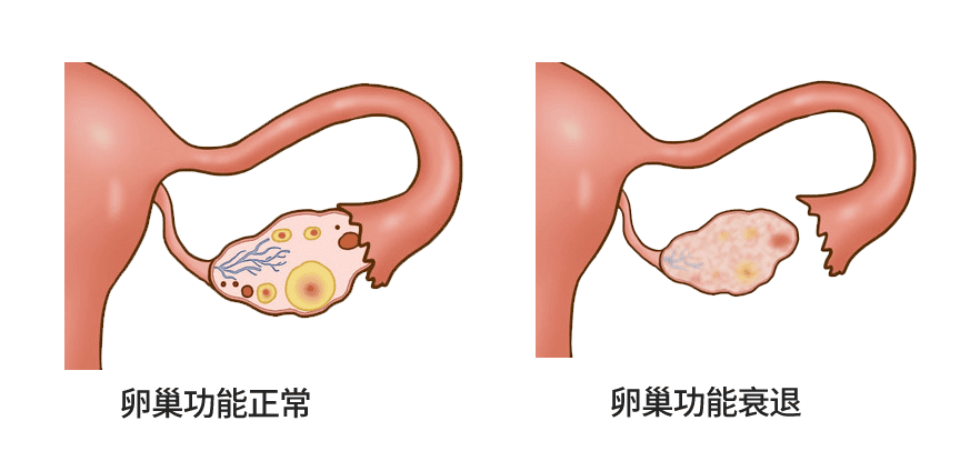 分钟自测「你需要做几次试管才能成功」！"