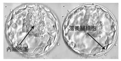 分钟自测「你需要做几次试管才能成功」！"