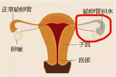 生化妊娠有解了，我不允许你还不知道！