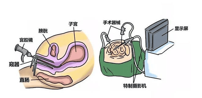 生化妊娠有解了，我不允许你还不知道！