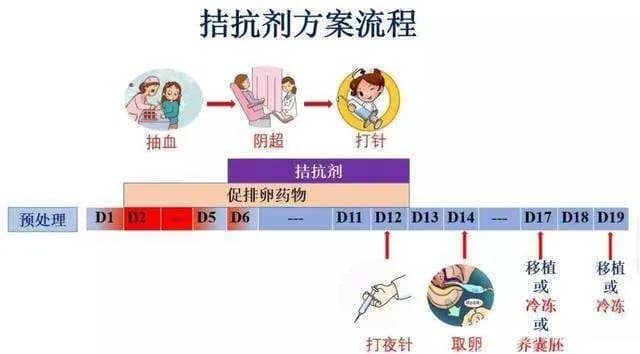 做试管婴儿，哪个促排方案成功率最高？