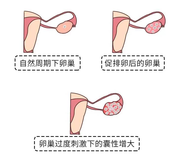 胚胎冷冻后能保存多久？你绝对想不到！