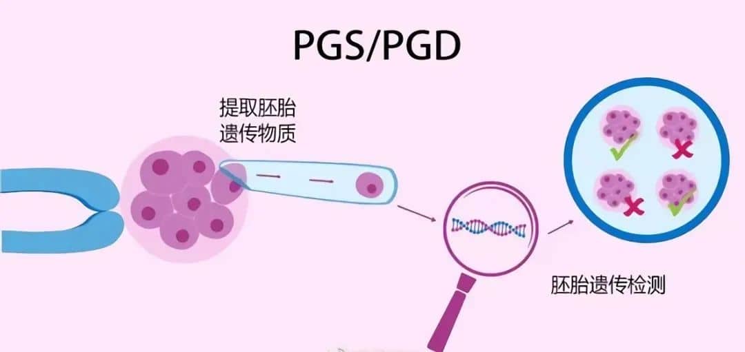 反复着床失败？或许是你忽略了这2个重要原因！