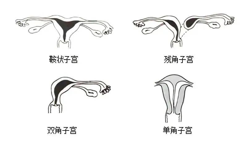 反复着床失败？或许是你忽略了这2个重要原因！