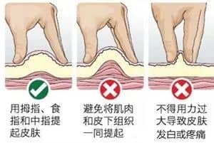 居家版低分子肝素注射技巧，你掌握了吗?