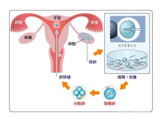 你以为试管婴儿都一样？其实这个才是成功的关键！