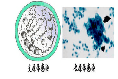 怀得好好的为什么胎停了？这5个高危因素你要知道！