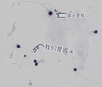 别瞎造了！精子存活率低也会影响试管成功率