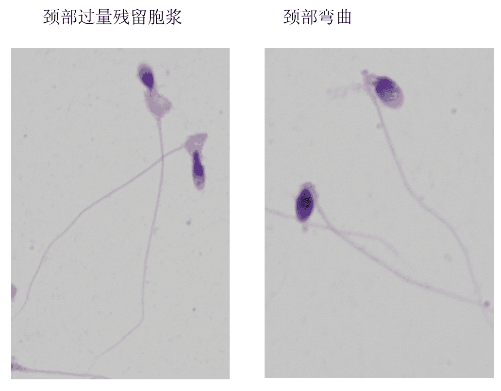 别瞎造了！精子存活率低也会影响试管成功率