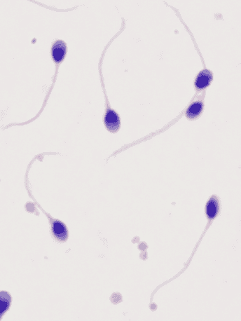别瞎造了！精子存活率低也会影响试管成功率