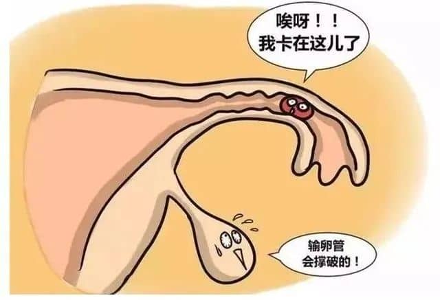 一文总结！先兆流产什么时候可以保胎？