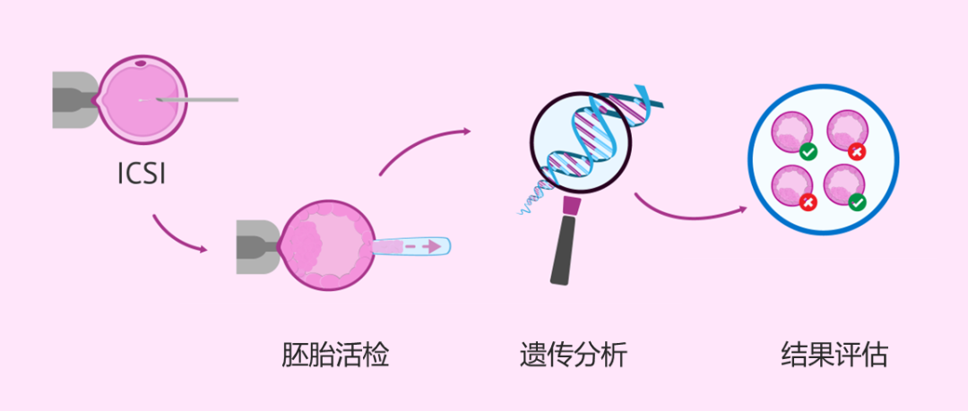 子宫内膜异位症的促排方案指南，哪个最适合你？