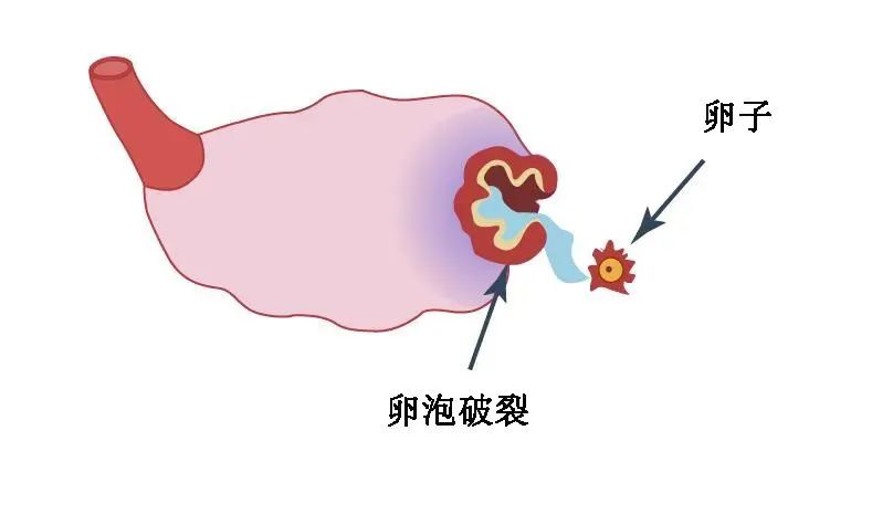 这三类人群，可以考虑一个促排周期取两次卵！