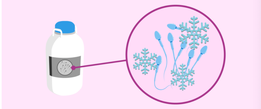 精子冷冻——给你的生育上个“保险”