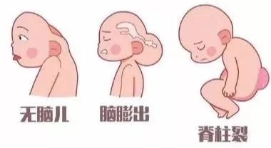 精子冷冻——给你的生育上个“保险”