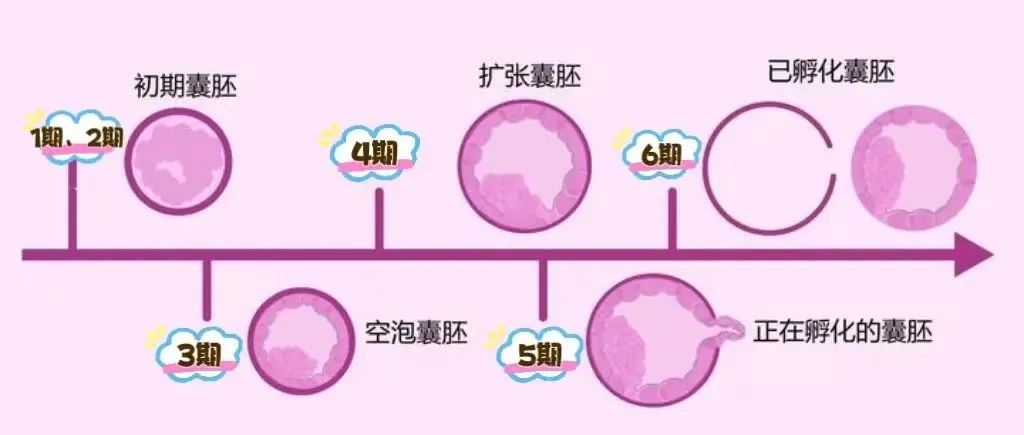 三代试管筛查结果出来了，该选哪个囊胚移植？