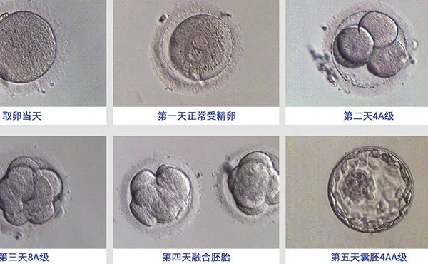 成功养囊=胚胎健康？90%的姐妹都不知道真相！