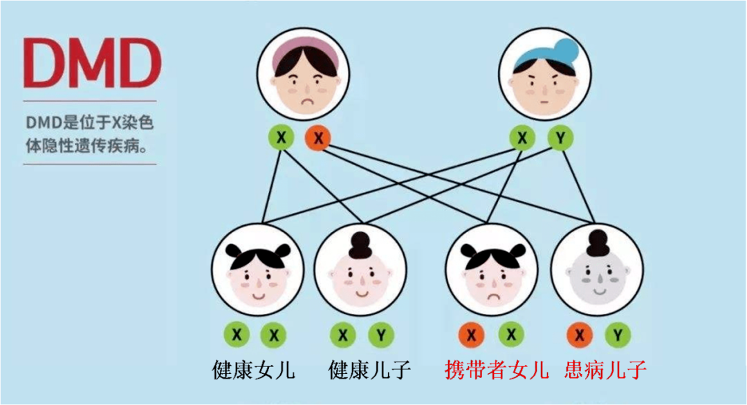 假肥大型肌营养不良症，该如何“逆天改命”？