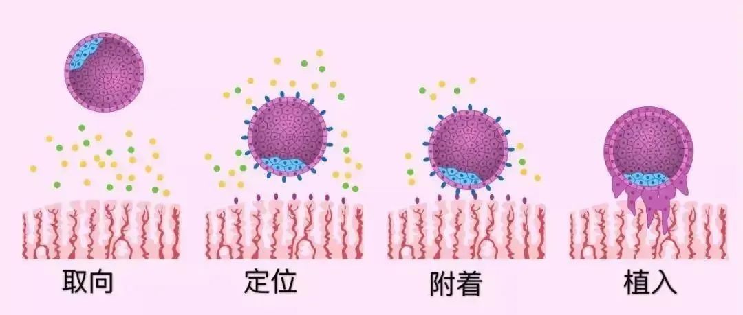 子宫内膜容受性分析对反复移植失败有没有用？