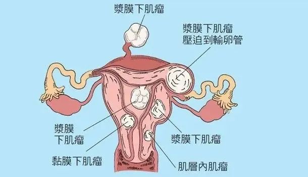 子宫内膜容受性分析对反复移植失败有没有用？