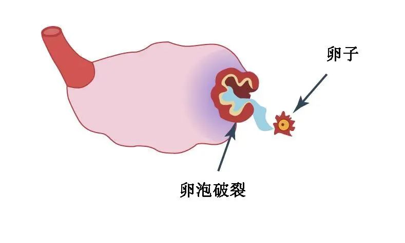 试管促排时遇到「空卵泡」，究竟是谁的错？