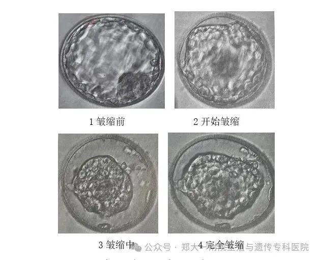 龙年接龙宝 | 带你揭秘囊胚的冷冻与复苏！