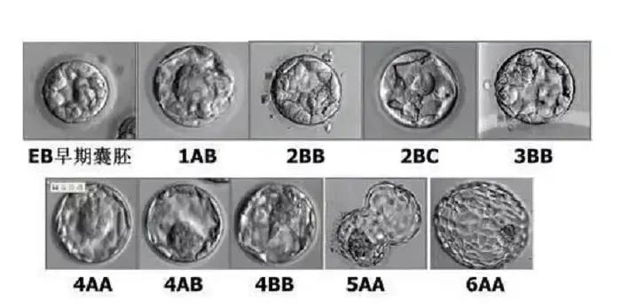 试管胚胎等级解读，看完这篇你全懂！