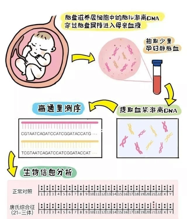 无创的Plus版——NIPT-plus，到底哪里不一样？