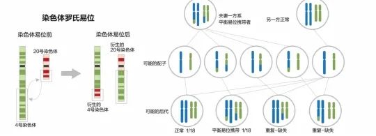 盘点三代试管的利与弊，一定有你不知道的真相！