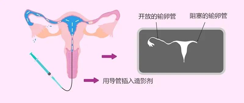 总是怀不上？这项技术能助40%不孕女性怀孕！