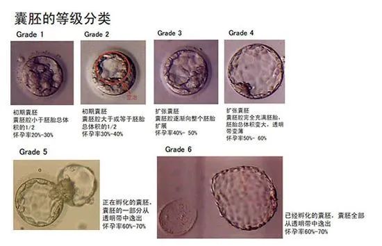 胚胎评分高就一定能成功怀孕？