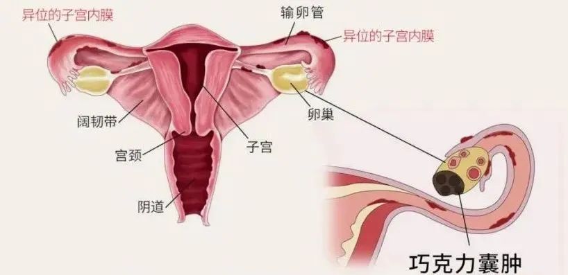 胚染异常逃不过这五个因素，看看你中了没！