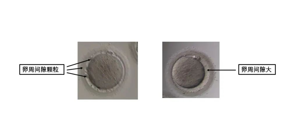 卵母细胞形态学异常对试管有什么影响?