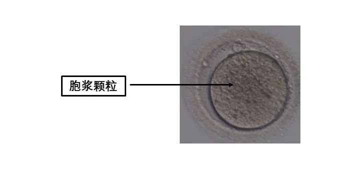 卵母细胞形态学异常对试管有什么影响?