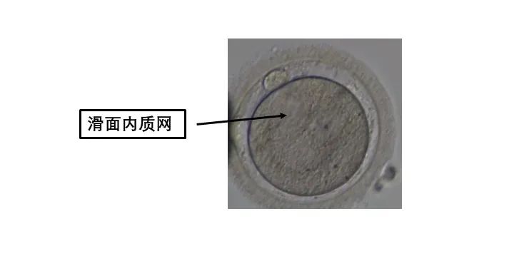 卵母细胞形态学异常对试管有什么影响?