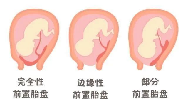 0+女性想快速抱娃，请看完这篇文章！"